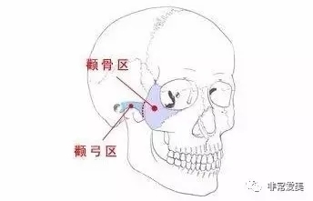 面部颧骨位置示意图