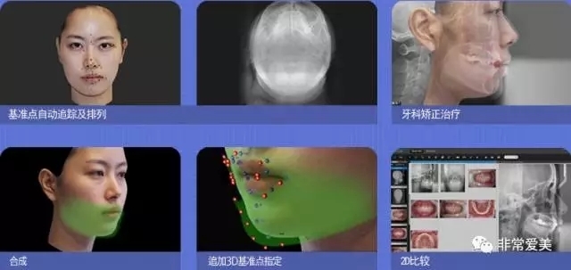 韩国做面部轮廓手术特色有哪些？