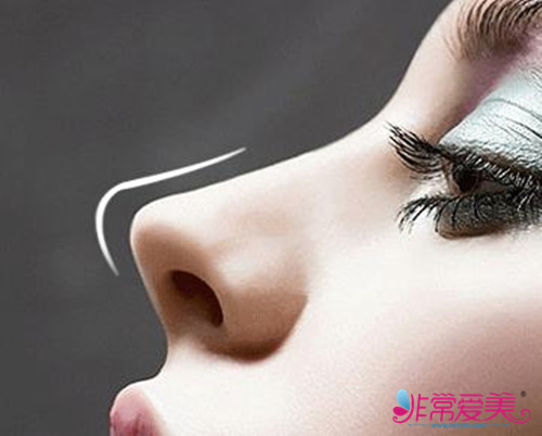 韩国鼻部整形失败类型及修复方法大盘点