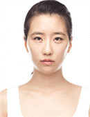韩国秀美颜医院鼻修复+面部脂肪填充手术恢复日记