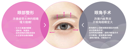 TL整形外科双眼皮技术科普