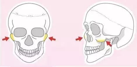 面部颧骨部位示意图