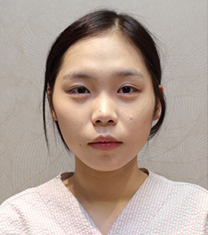 韩国Roseand整形医院-韩国Rose and整形医院隆鼻案例对比图