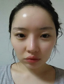 韩国巴诺巴奇整形外科-网友带你亲身体验，韩国巴诺巴奇面部轮廓整形日记！