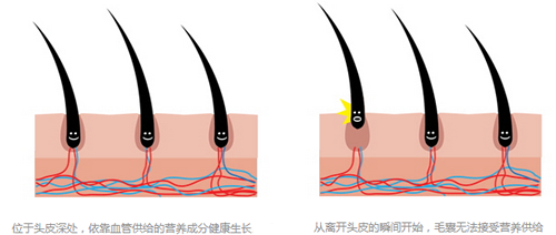 传统植发方式毛囊成活率低