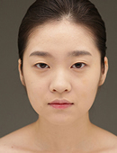 韩国iWell爱我整容外科-韩国爱我整形外科面部轮廓整形案例！