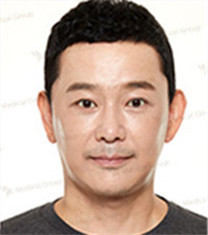 JK整形美容医院-韩国jk医院男士双眼皮+抗衰老手术对比案例