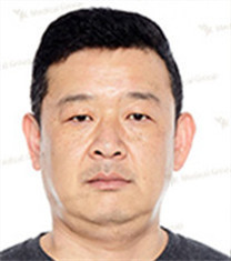 JK整形美容医院-韩国jk医院男士双眼皮+抗衰老手术对比案例
