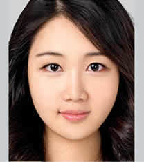 北京伊美尔医疗美容眼部综合整形案例对比图