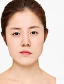 韩国CLAIR整形外科-左右脸不对称怎么办？CLAIR医院来搞定