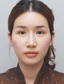 韩国丽珍整形外科-丽珍整形医院面部轮廓三件套对比日记图