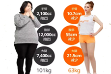2018女人标准体重表来了，365MC医院吸脂减肥享“瘦”哪随你