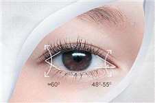 开眼角容易增生留疤吗？韩国哪些医院值得推荐？
