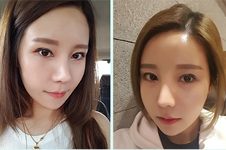 秀美颜眼鼻修复技术在韩国知名吗，医院地址在哪里？
