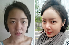 韩国眼睛修复好医院收集（十）：女神VS秀美颜