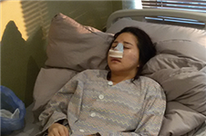 韩国GNG医院揭秘鼻尖抬高术恢复过程图及案例效果