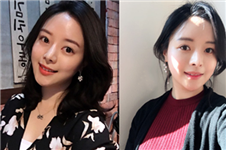 韩国ID医院修复隆鼻失败手术真人日记分享