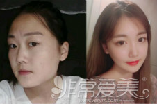 曝光：韩国一路美脸型整形特色+真人案例分析！