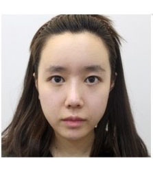 韩国ACE整形-韩国ace鼻部+童颜整形前后对比