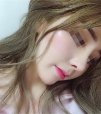 韩国Premiere-韩国普瑞美整形医院隆鼻前后对比照片