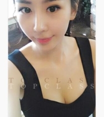 韩国顶级整形-韩国TOPclass眼鼻隆胸手术前后照片