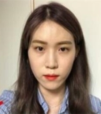 韩国娜娜NANA整形医院-韩国NANA娜娜眼鼻综合整形+V-LINE+面部脂肪填充前后对比照片