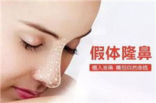 中韩常用隆鼻材料PK：硅胶、膨体、超体、misko谁更受欢迎？