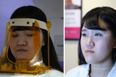 韩国正颌手术恢复过程日记多图记录变化！
