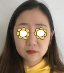 北京当代医疗美容面部吸脂30天恢复日记