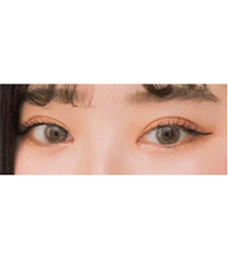 韩国Rio丽偶整形外科-韩国Rio丽偶双眼皮手术真人日记自拍对比
