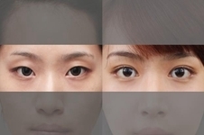 韩国纯真整形医院和原辰整形医院哪家双眼皮效果比较好？