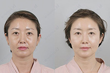 韩国江南有名的整形外科：这几家规模大收费贵 安全系数高