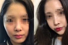 韩国丽丝塔金东奭做鼻子怎么样，和cocoline能比吗？