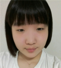 韩国卡拉美尔整形外科眼鼻整形案例