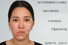 韩国菲斯莱茵李真秀,面部轮廓矫正案例分析