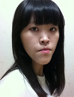 韩国原辰整形外科-朴原辰地包天矫正+面部轮廓对比图
