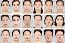韩国必妩医院怎么样？面部轮廓案例效果对比明显吗？
