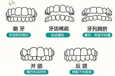 2020年末煙臺牙科牙齒矯正價格:隱形半隱形舌側(cè)金屬矯正齊了