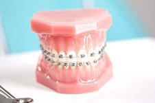 广州牙齿矫正比较好的口腔诊所都有谁？内附牙齿矫正价格
