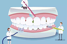 普通洗牙一次多少价格?分享北京洗牙价格收费表!