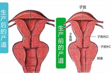 廣州陰道松弛產(chǎn)后緊縮術(shù)什么價(jià)位？哪家做的好