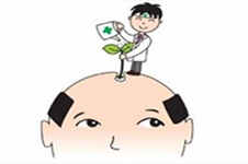 在徐州想植发去哪家医院比较好？植发有后遗症吗