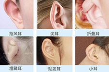 上海小耳朵畸形整形哪家好?这五家医院做耳畸形效果有保障!