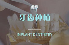 天津口腔医院种牙价格表分享,植体一颗多少钱哪里种牙便宜?