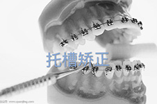 上海臻威口腔门诊怎么样,据说做牙齿矫正好看案例及价格!
