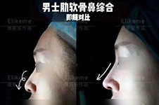 上海伊莱美做鼻子医生盘点:邱文苑,李湘原,顾新安哪个更好?