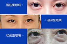 郑州去眼袋好的整形医生有哪些?这几位做眼袋无痕效果佳!