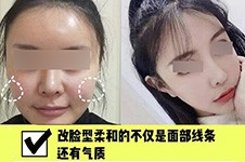 上海伊莱美磨骨怎么样？优势揭秘为何他家人气这么高！