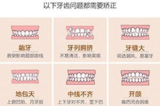 鄭州箍牙一般多少錢，暑期做牙齒矯正價格能便宜嗎？