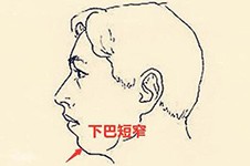 上海豐下巴費(fèi)用要多少？當(dāng)?shù)刈鱿掳驼文膫€(gè)醫(yī)院好？